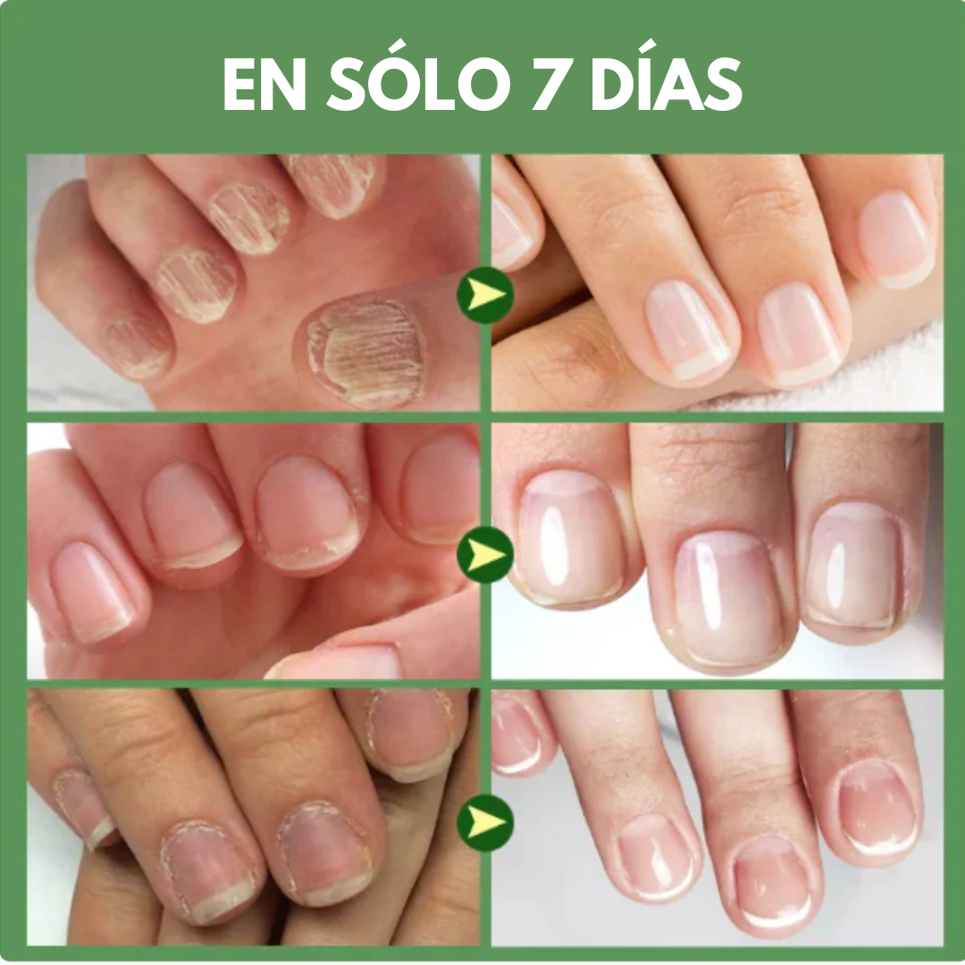 COMBO BASES ENDURECEDORA UÑAS DE TITANIO x 2